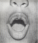Mouth
